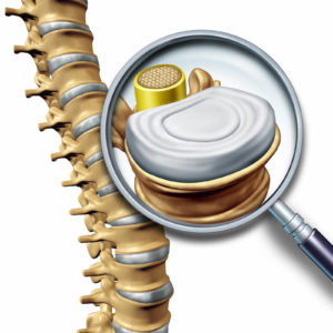 spinal traction Longmont