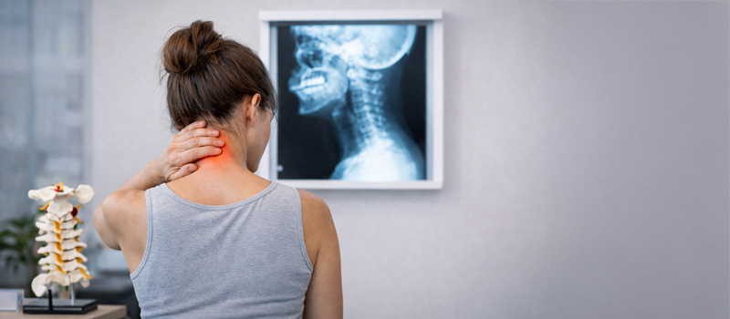 Woman experiencing occipital neuralgia with pain at the base of the skull and cervical spine x-ray in background